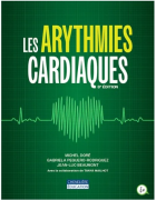 Les arythmies cardiaques